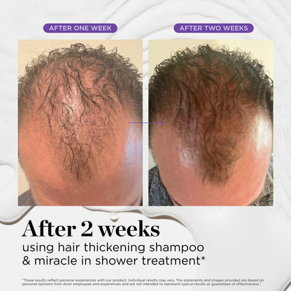 Scalp Revitalizing Solution Miracle in Shower Treatment